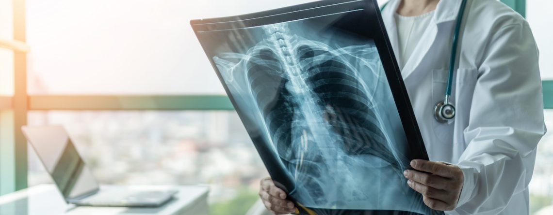 Understanding Pulmonary Disease Management
